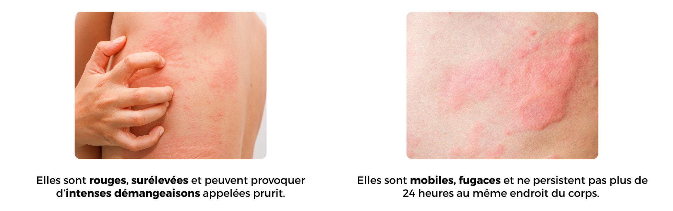 BVMP UCS page comprendre papules