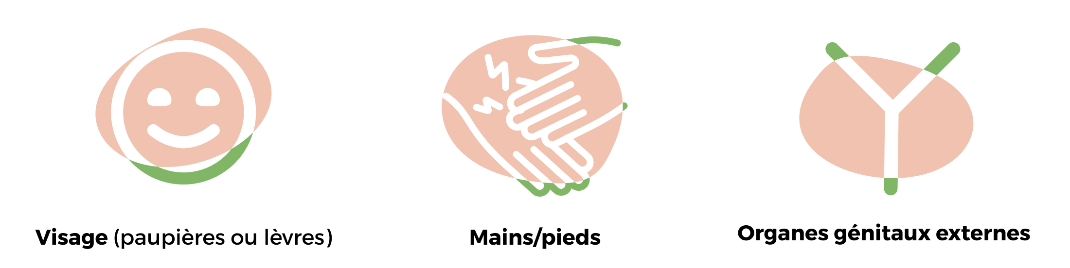 BVMP UCS page comprendre angioedeme