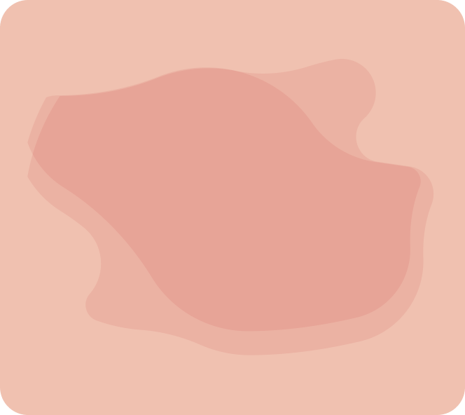 La greffe de peau ou de lambeau