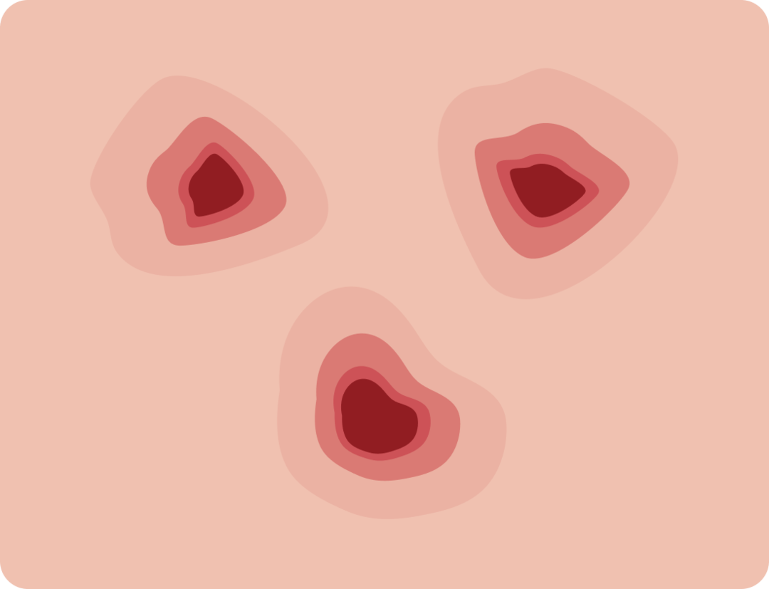 Le deroofing