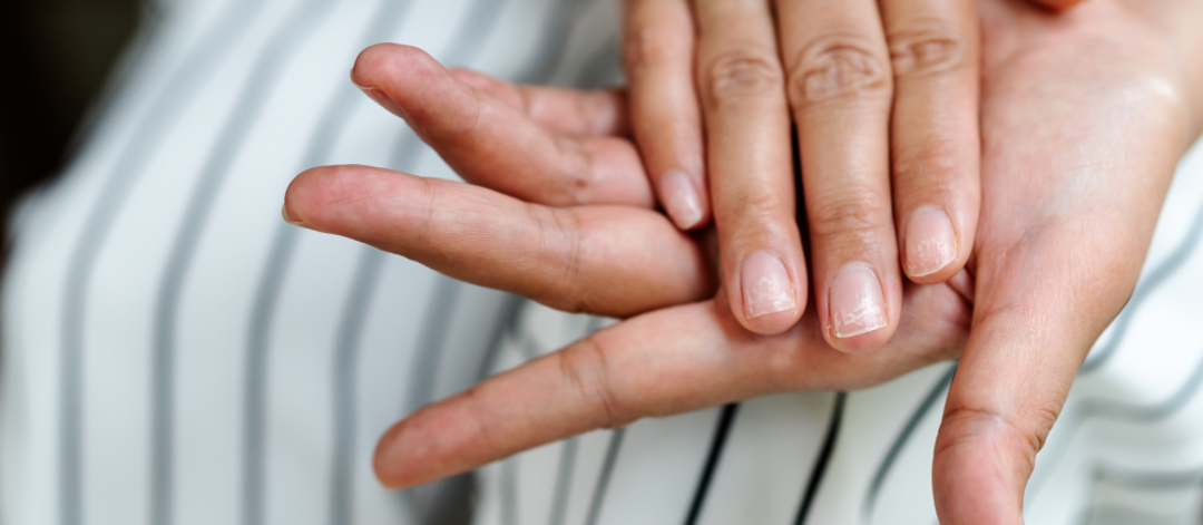 ongles