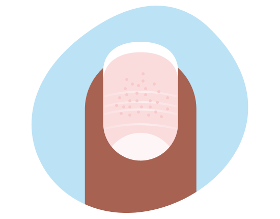ongle