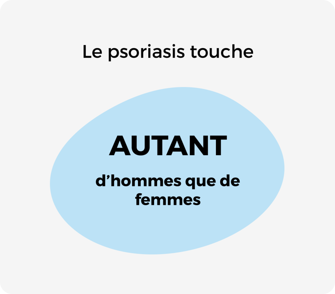 Le psoriasis touche autant d'hommes que de femmes