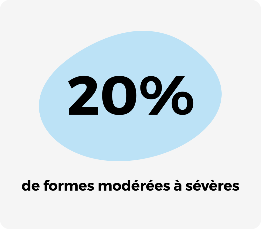 20% de formes modérées à sévères