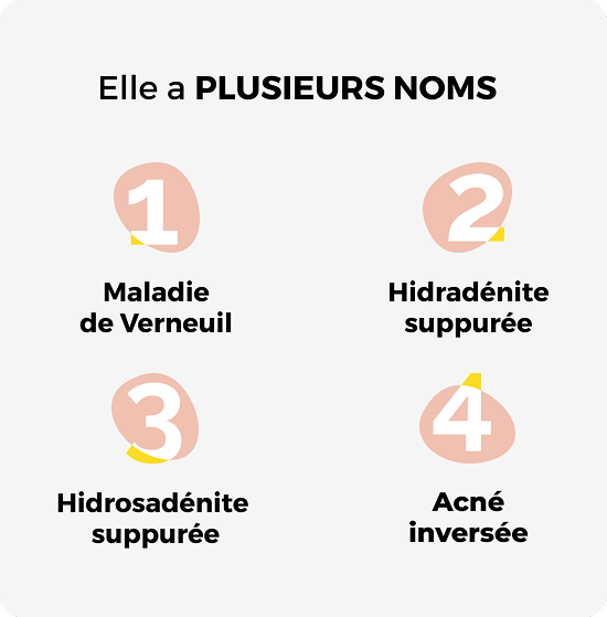 elle a plusieurs noms