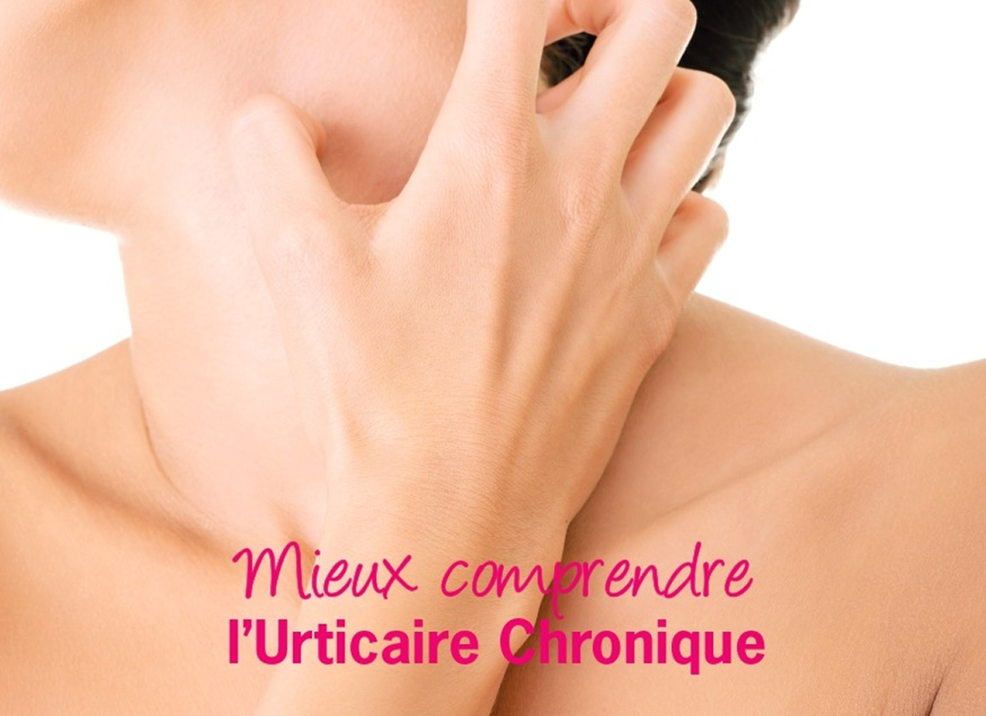 Brochure mieux comprendre mon urticaire